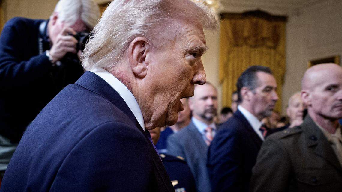 Trump es visto con una gran mancha roja en el cuello