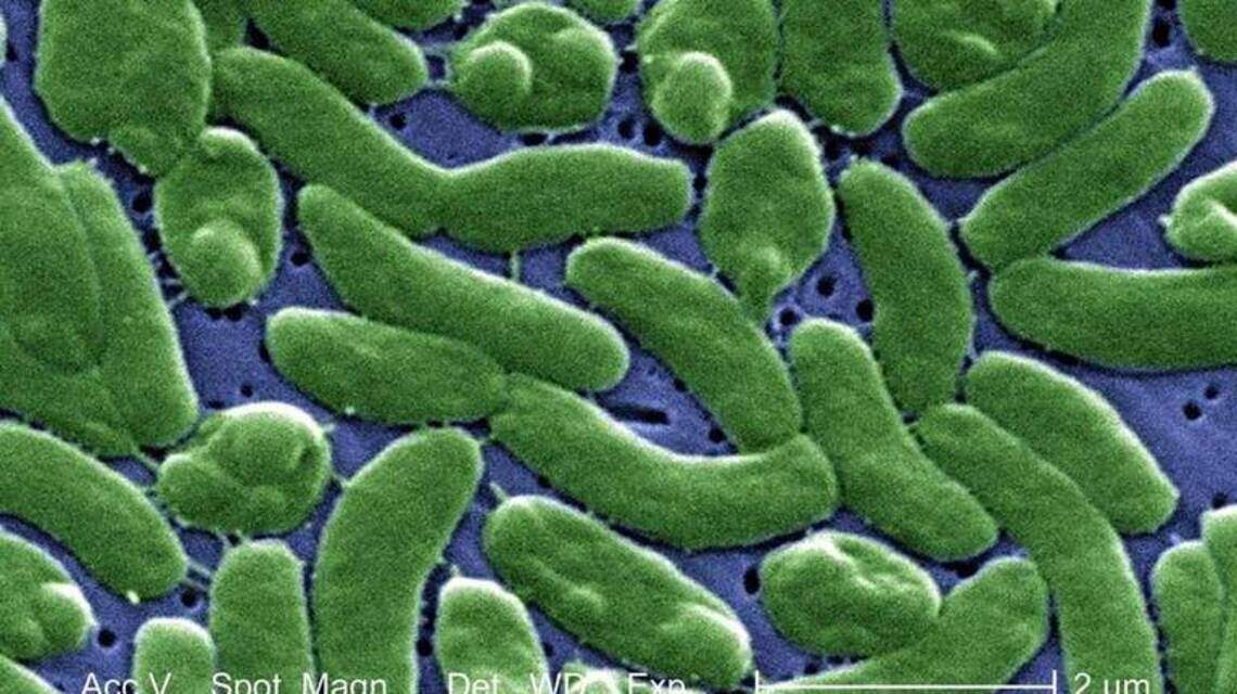 Reportan ocho muertes en lo que va del año a causa de la peligrosa bacteria que come carne
