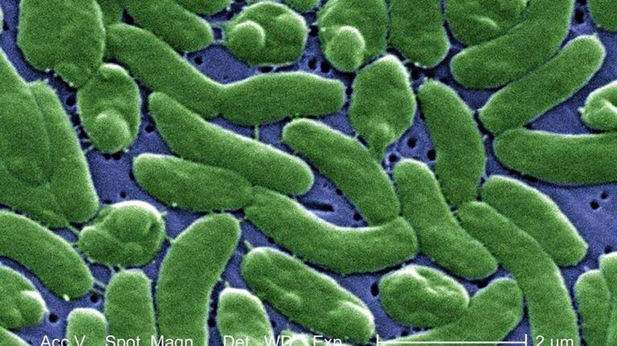 Imagen magnificada de un microscopio que muestra un grupo de bacterias “vibrio vulnificus”.