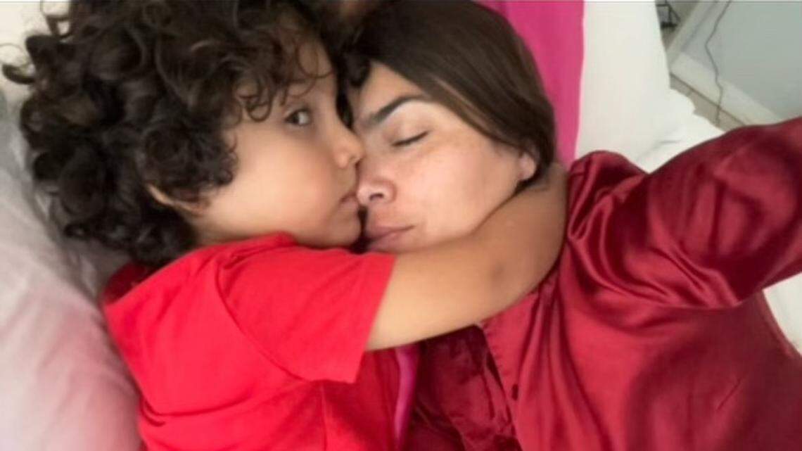 Los implantes de seno no la dejaban abrazar a su hijo. Un cirujano plástico de Miami fue su salvación