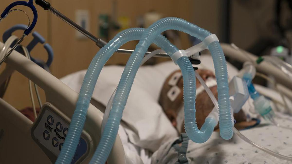 A COVID-19 patient on a ventilator.