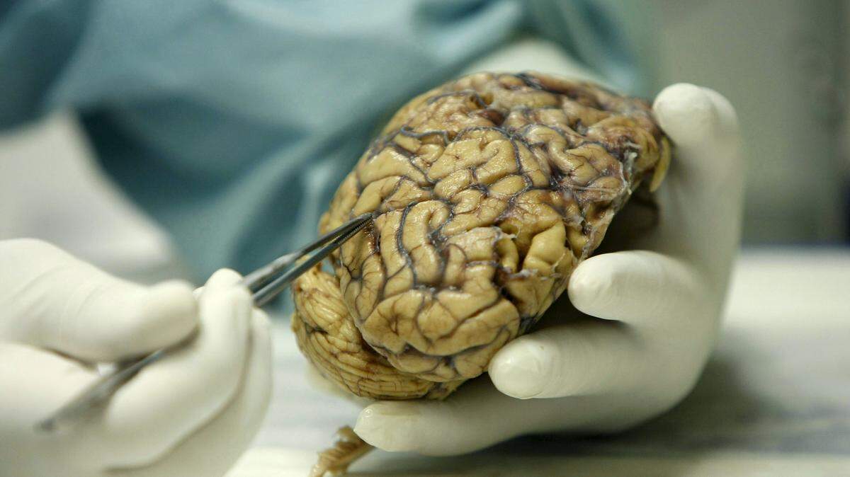 Según Manes es probable que en los próximos siglos sea posible crear o regenerar el tejido neuronal del cerebro.
