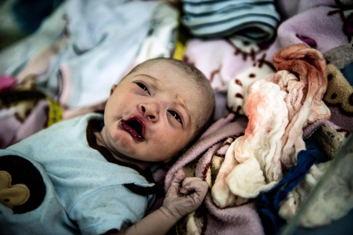 Cristangely, la hija de Smith, minutos después de nacer