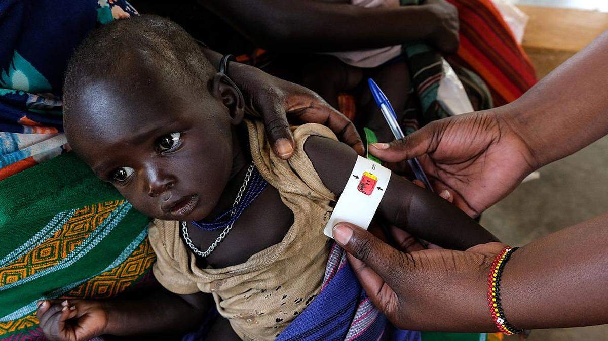 KOTIDO, UGANDA - JULY 23: A health worker measuring a child's Mid Upper - Arm Circumference during a nutrition screening at Losilang Health Center II in Kotido district on July 23, 2025 in Karamoja region, Uganda. The child turned out to be severely malnourished and was referred to the hospital. The Karamoja region in north-eastern Uganda has the highest rates of food insecurity and malnutrition within the East African country, with 45% of the population (approximately 600,000 people) in crisis, according to data from the UN World Food Programme (WFP) and Food Security and Nutrition Assessment (FSNA). To combat the hunger crisis in Karamoja, WFP works with the Ugandan government to run a program of malnutrition treatment, prevention, and intervention, as well as agricultural support for local farmers. However, food insecurity in the region has been exacerbated by the double-edged sword of increasingly unpredictable weather impacting harvests and dramatic cuts to foreign aid. Following US President Donald Trump's executive order in January to defund the United States Agency for International Development(USAID), WFP is now facing a projected 40% reduction in its funding for 2025, leaving an estimated 58 million people around the world vulnerable to starvation. (Photo by Hajarah Nalwadda/Getty Images)