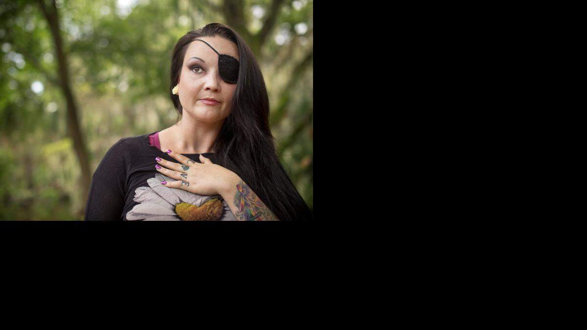 
Joi Partain, una mujer de Orlando que fue brutalmente golpeada por su novio.


