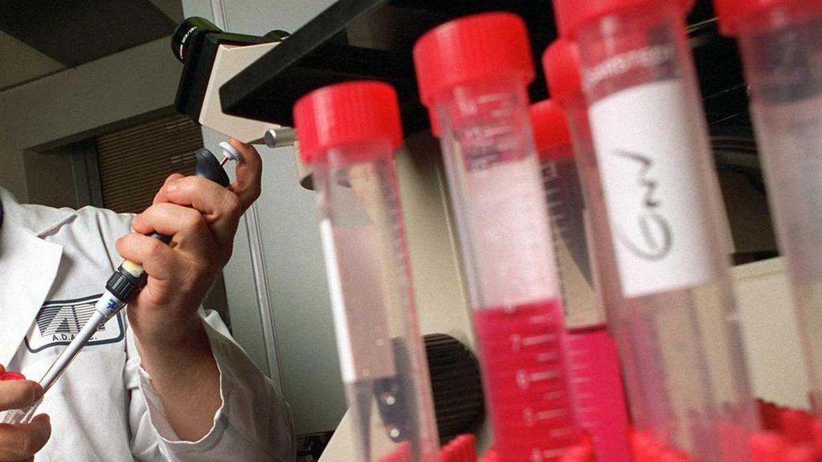 Un grupo de científicos en Estados Unidos ha descubierto un nuevo método para eliminar células en las que el VIH permanece latente e invisible para el sistema inmunológico.