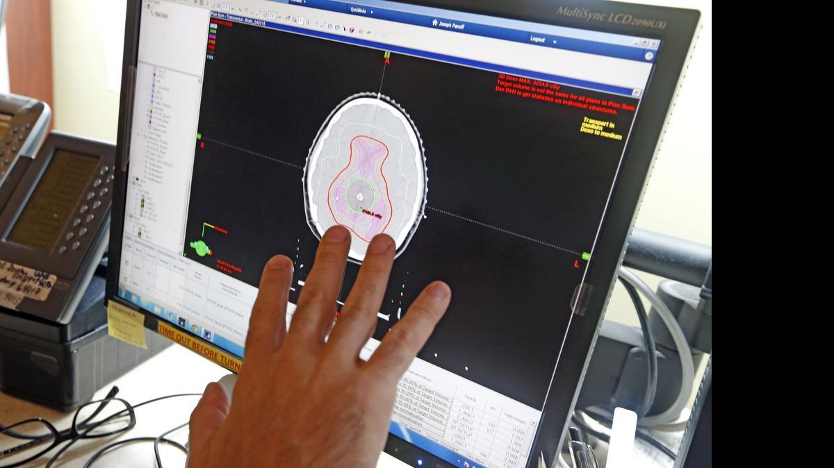 
El Dr. Joseph Panoff estudia una imagen del cerebro tomada a la paciente Elizabeth Rodríguez. Panoff es profesor de radiación oncológica del departamento de radiología oncológica del Sylvester Comprehensive Cancer Center (centro integral de cáncer) de la Universidad de Miami.


