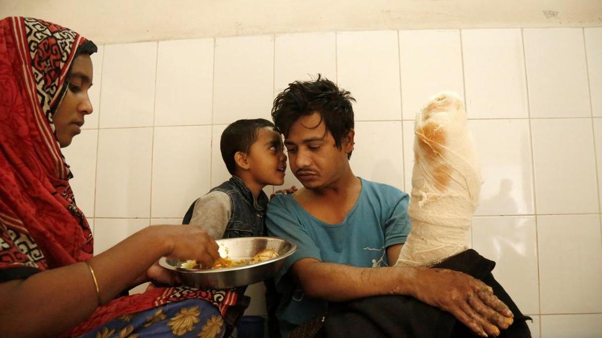 Abul Bajandar (dcha), conocido como 'hombre árbol', recibe comida de manos de su esposa, Halima Akter en una habitación de la unidad de quemados del hospital, en Daca, Bangladés, el 30 de enero de 2018. Bajandar, quien permanecerá dos años en el hospital, ha sido sometido a 19 operaciones para eliminar las verrugas de sus extremidades.