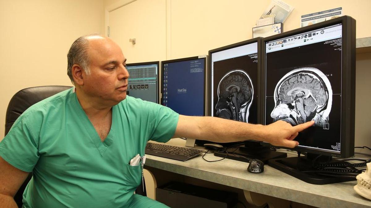 
El Dr. Allen B. Kantrowitz, Jefe de la división de neurocirugía de Mount Sinai Medical Center, muestra una imagen de Malformación de Chiari tipo 1. .
