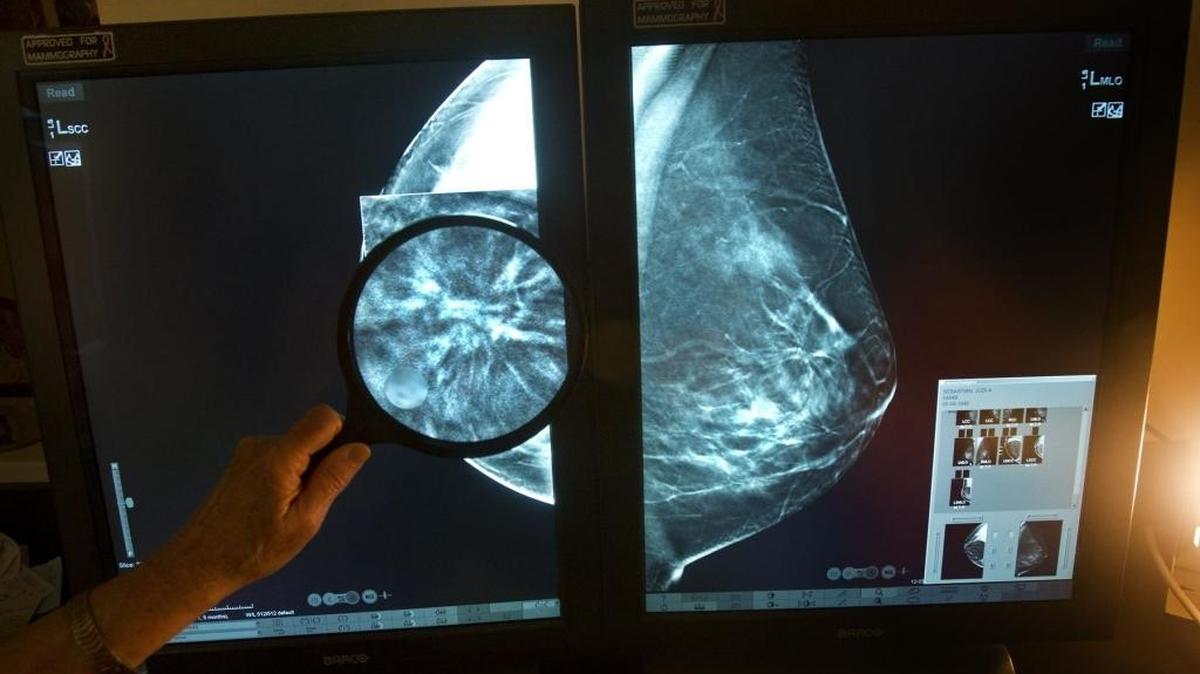 La Dra. Nilza Kallos, radióloga, lee una imagen de la nueva máquina que produce mamografías en tres dimensiones. Esta nueva tecnología hace más fácil encontrar tumores cancerosos en etapas tempranas.