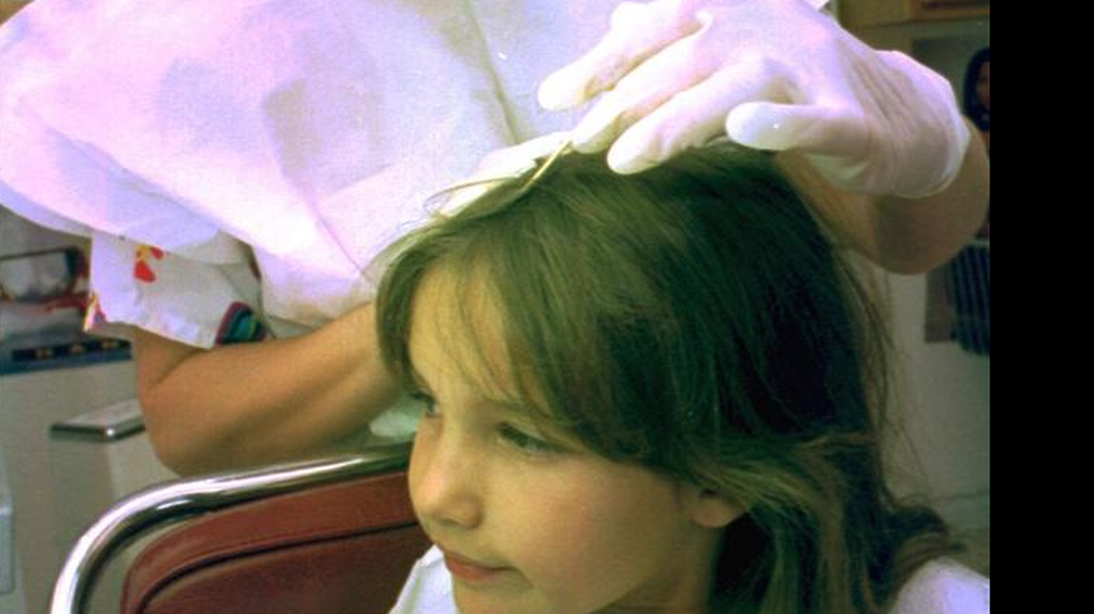 
‘Revise el cabello de sus hijos’, recomienda el Departamento de Salud del Condado. Cualquier persona puede contraer piojos. Contraerlos no tiene nada que ver con la limpieza y tenerlos no hace que a usted se le considere un padre de familia deficiente. La niña en la foto es revisada por una especialista.
