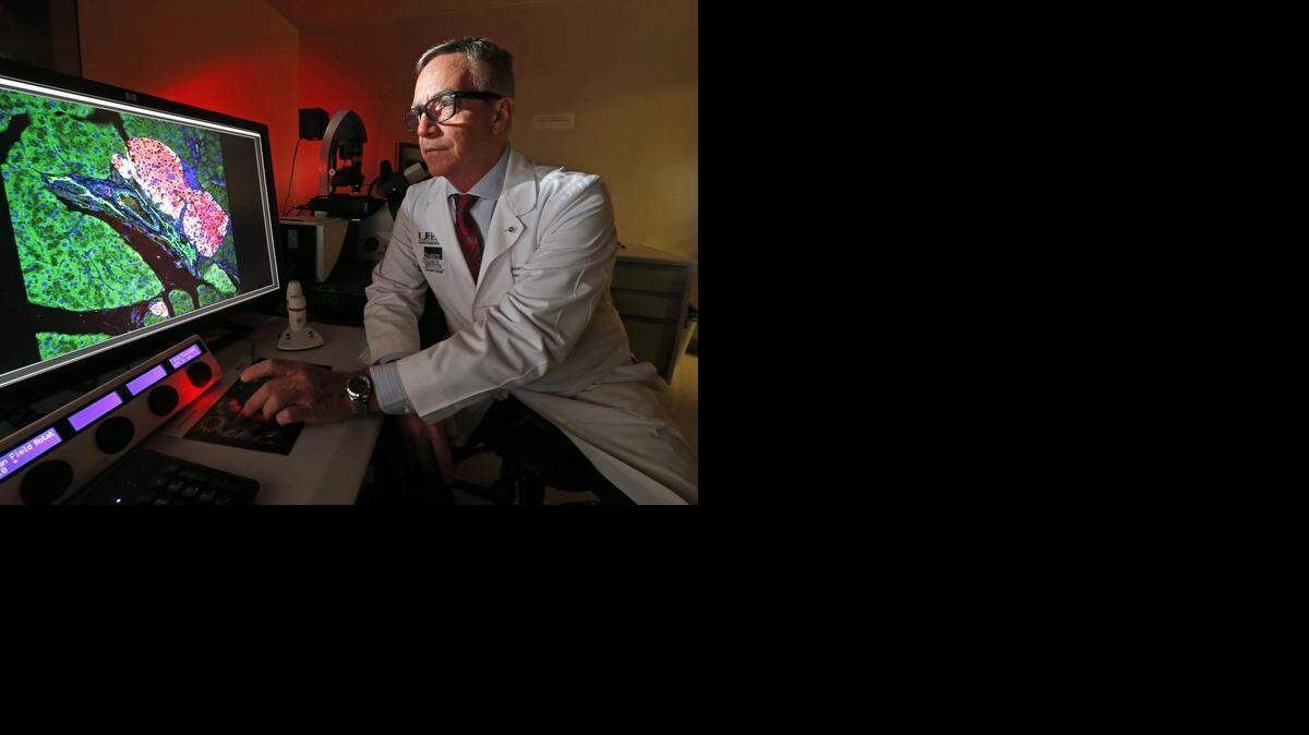 
El Dr. Camillo Ricordi muestra en una computadora las células islotes. La investigación que dirige mueve islotes de células purificadas del páncreas de un donante de órgano fallecido, a un paciente con diabetes Tipo 1 a través de un proceso complejo de transfusión.


