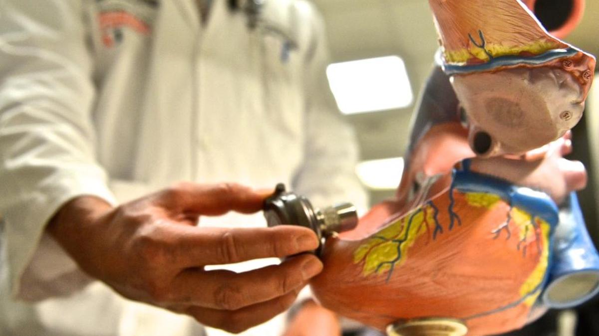 El pronóstico del infarto de miocardio dependera de la cantidad de la pared del corazón que se ha destruido.