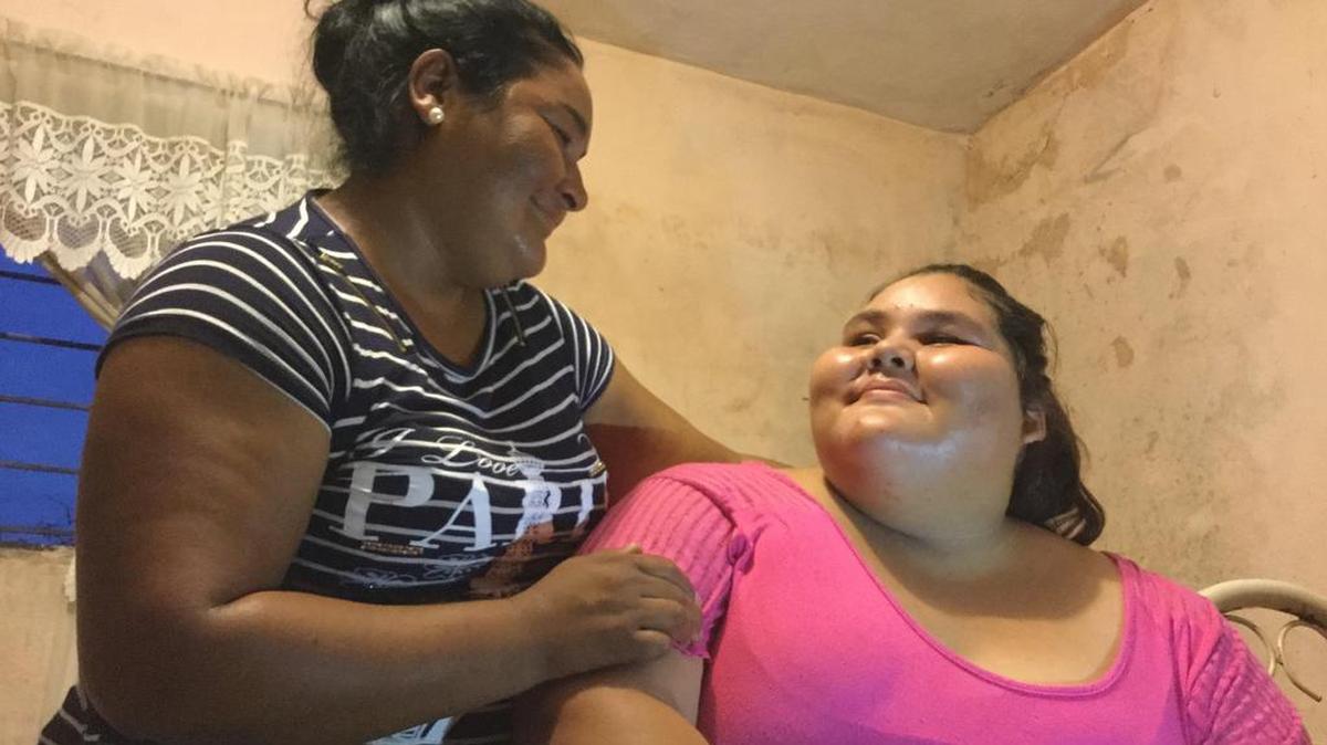 La adolescente mexicana Dayana Camacho, a sus 14 años y con 195 kilos de peso, acompañada por su madre Ramona Carrillo (i) espera ansiosa una operación de reducción de estómago que confía que mejore su salud y le cambie la vida, marcada por un exceso de peso que condiciona su día a día y es un ejemplo más del grave problema de la obesidad en México.