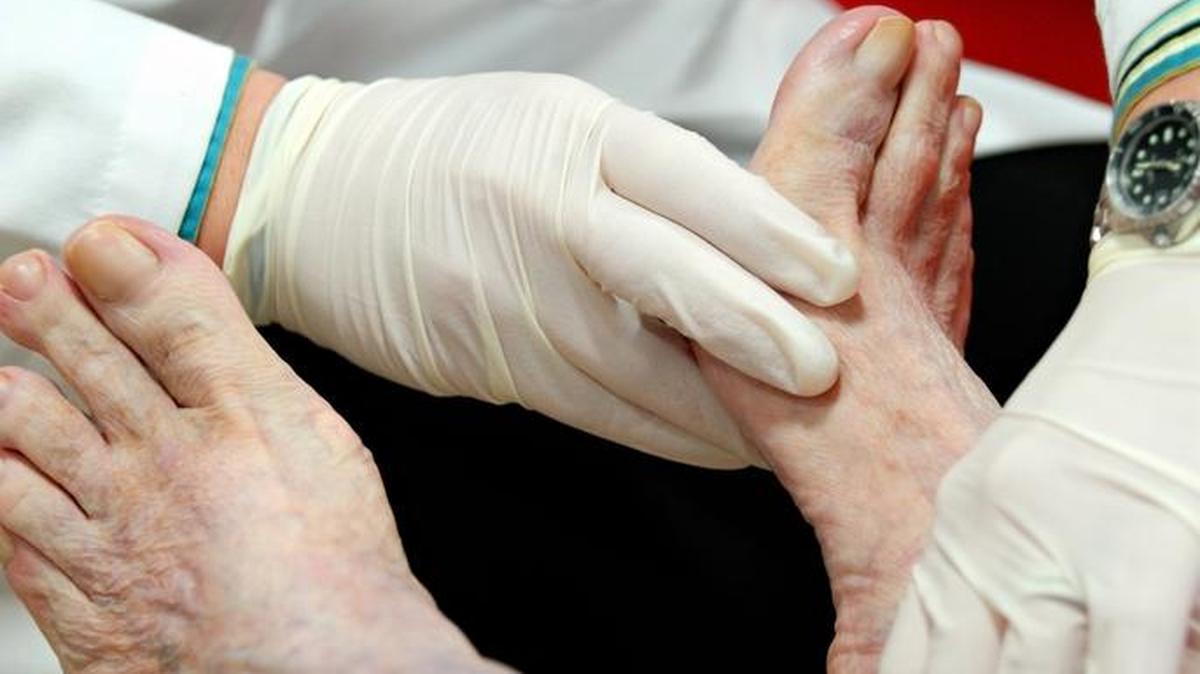 Examen de los pies de un paciente diabético.